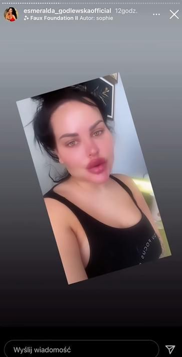 Esmeralda Godlewska z nadwagą