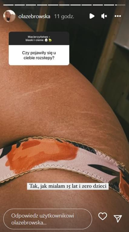 Ola Żebrowska pokazała rozstępy