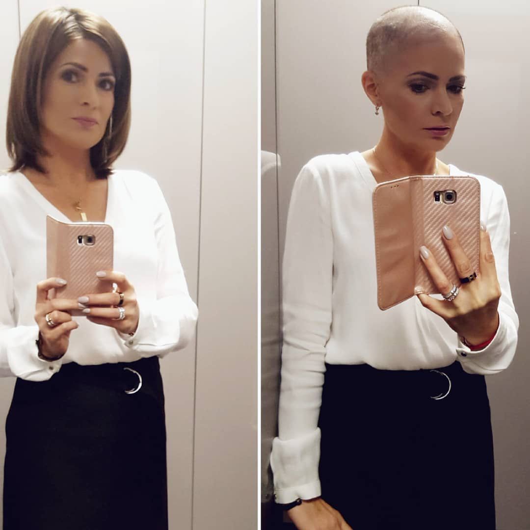 Górska pokonała raka! Opublikowała zmysłowe zdjęcie w bikini