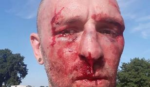 Pobicie dziennikarza Przemysława Witkowskiego we Wrocławiu. Oskarżony: To ja jestem ofiarą