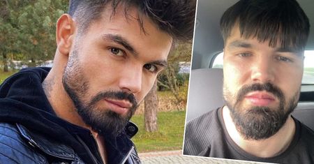 Paweł z „Love Island” nie oszczędza drastycznych widoków. Właśnie pokazał, jak bardzo zmasakrowano mu policzki. Coś strasznego