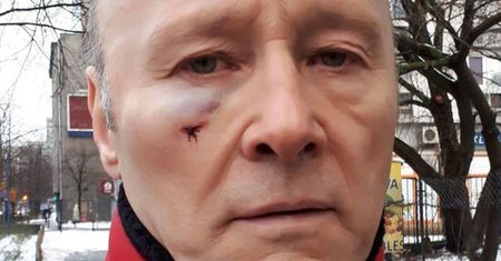 Mocny komentarz o ataku na Pieczyńskiego: "Był wyzywany od pedałów i pobity za zwykłą, czerwoną kurtkę!"