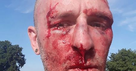 Przemysław Witkowski został pobity. "Nie przesadzałbym, że mamy do czynienia z falą terroru"