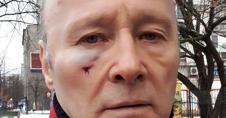 Znany aktor pobity. Prokuratura podjęła decyzję