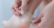 Odcisk na stopie - profilaktyka i domowe sposoby na odciski na palcach i piętach