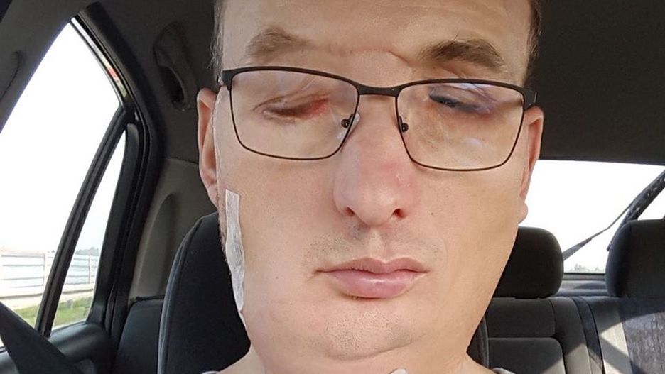 Niecałe 5 lat temu Grzegorz przeżył wypadek w zakładzie kamieniarskim