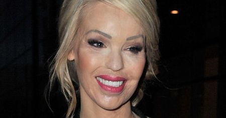 Katie Piper: ofiara ataku kwasem spodziewa się dziecka!