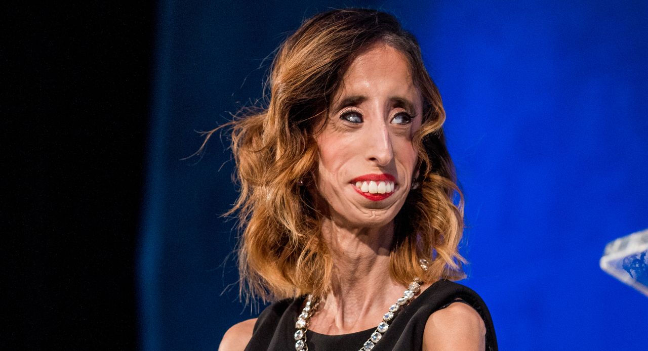 Lizzie Velasquez została nazwana "przerażającą". Teraz ma ważne przesłanie do wszystkich