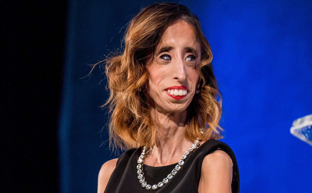 Lizzie Velasquez potrafi dostrzec w sobie piękno. Aktywistka mówi, co w sobie lubi