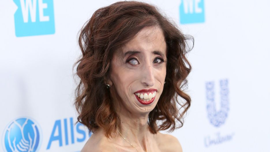 Lizzie Velasquez pokazała swoje zdjęcia z przeszłości