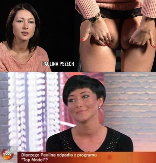 "Top Model": uczestniczka 1. edycji wszczepiła sobie implanty pośladków!