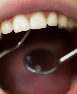 Lek na infekcje jamy ustnej wycofany z obrotu