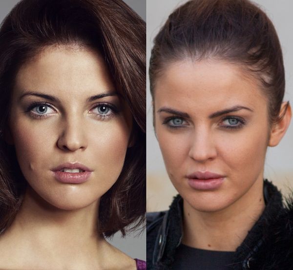 "Top Model": Justyna Pawlicka powiększyła sobie usta? Ogromne!