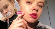 Julia Wróblewska powiększyła usta. Podekscytowana metamorfozą wszystko pokazała w sieci