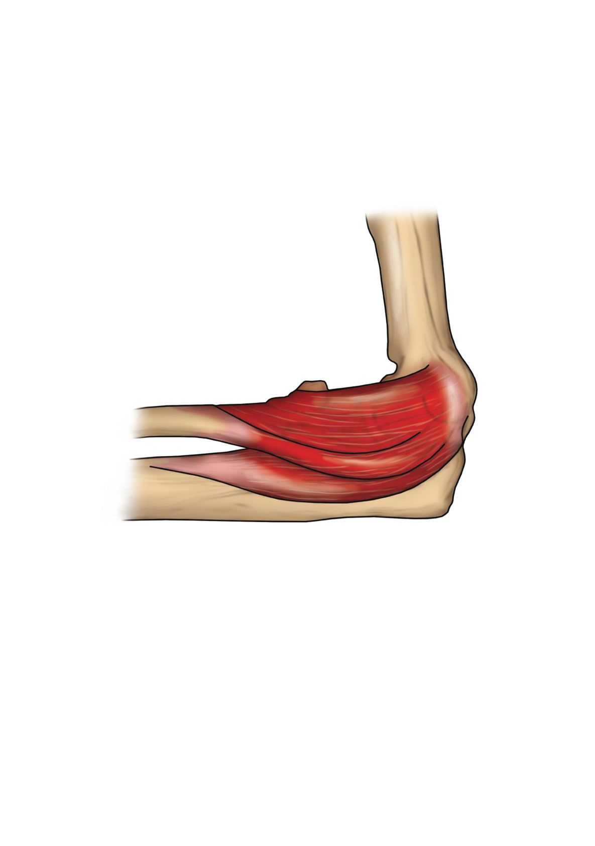 Prostowniki nadgarstka