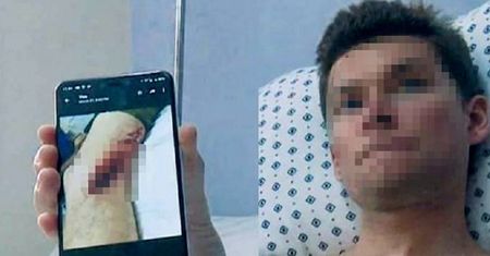 Rekin zaatakował w Meksyku. Turysta ma poranioną nogę