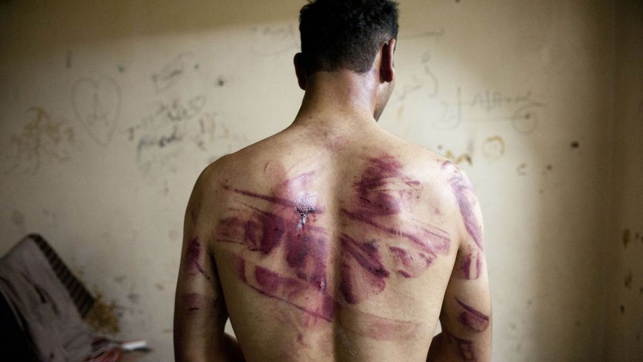 Mężczyzna, który był torturowany w więzieniu w Syrii