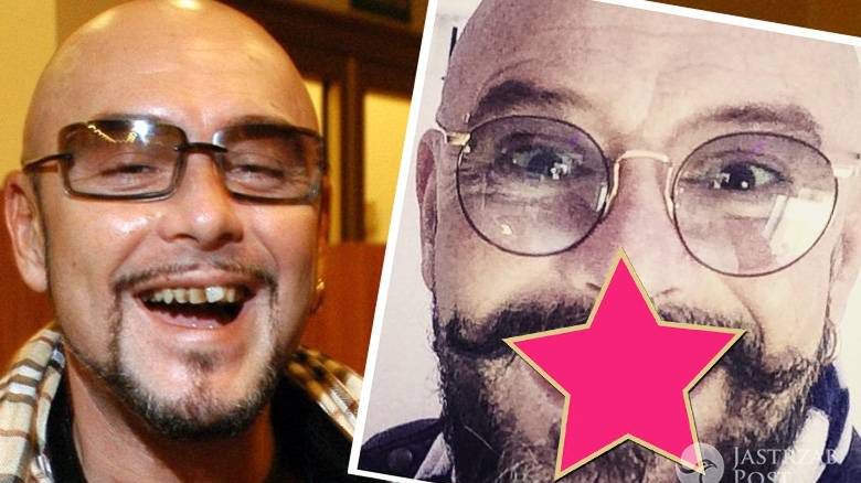 Tomasz Jacyków pochwalił się nowym uśmiechem