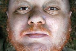 Topielec z jeziora Długiego w Olsztynie. Kim jest tajemniczy mężczyzna z raną postrzałową głowy?