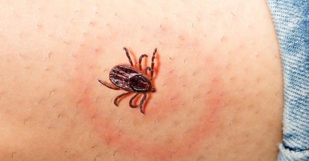 Prosty spray na kleszcze. Najskuteczniejszy naturalny środek, który je odstraszy