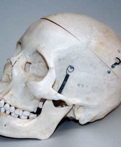 Dwie czaszki ponad 70 lat leżały w szafie niemieckiego lekarza. Eksperci ustalą do kogo należały?