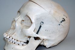 Dwie czaszki ponad 70 lat leżały w szafie niemieckiego lekarza. Eksperci ustalą do kogo należały?