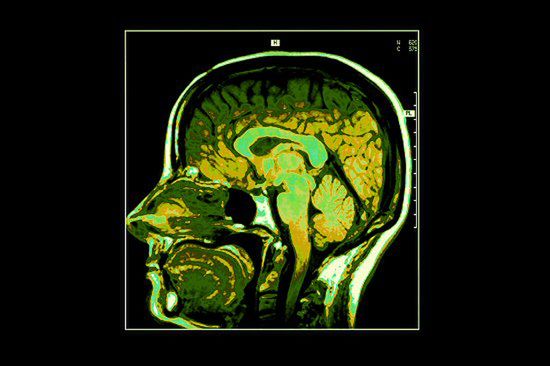 Naukowcy z Poznania odkryli, jak leczyć raka mózgu