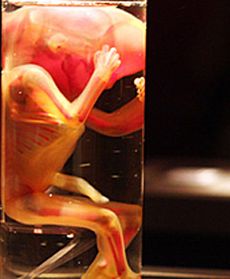 Kontrowersyjna wystawa ludzkich zwłok