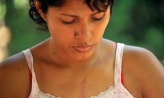 Porażająca skala przemocy wobec kobiet w Ameryce Łacińskiej