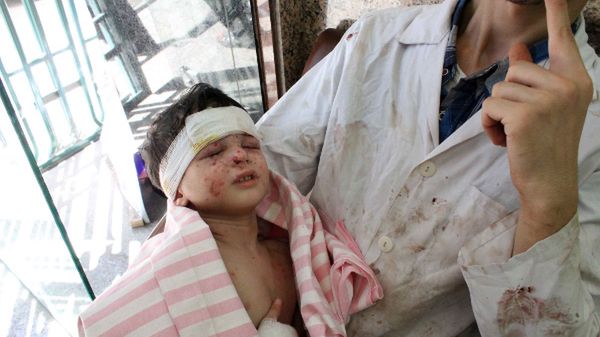 Dzieci w Syrii stają się również ofiarami bombardowań