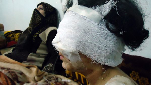 Dziewczynka ranna podczas ostrzału Hims