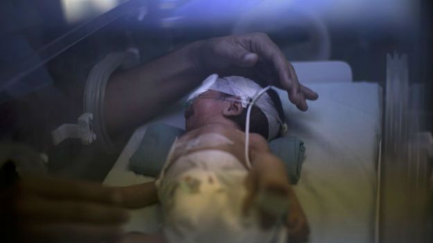 Dziecko jest cały czas pod opieką lekarzy