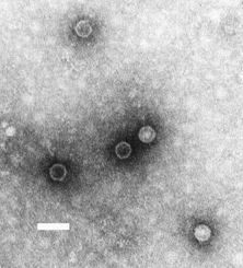 Zdjęcie wirusa Polio 