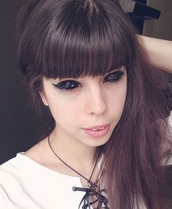 Jest szansa na uratowanie wzroku fanki Popka z wytatuowanymi oczami. Podjęta będzie heroiczna walka