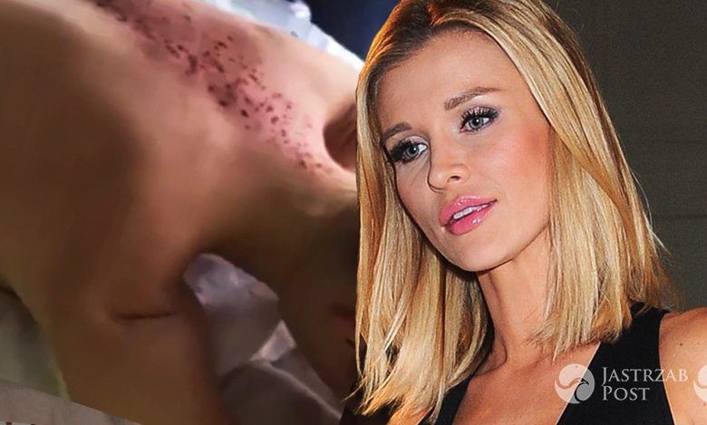 Joanna Krupa poddała się zabiegowi - to tradycyjna metoda walki z infekcjami. Chociaż wygląda dosyć przerażająco