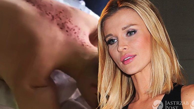 Joanna Krupa stosuje bańki
