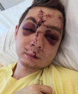 Zatrzymano kierowcę, który potrącił 22-letniego Kacpra