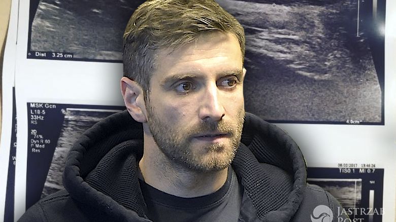 Maciej Dowbor zerwał ścięgno Achillesa