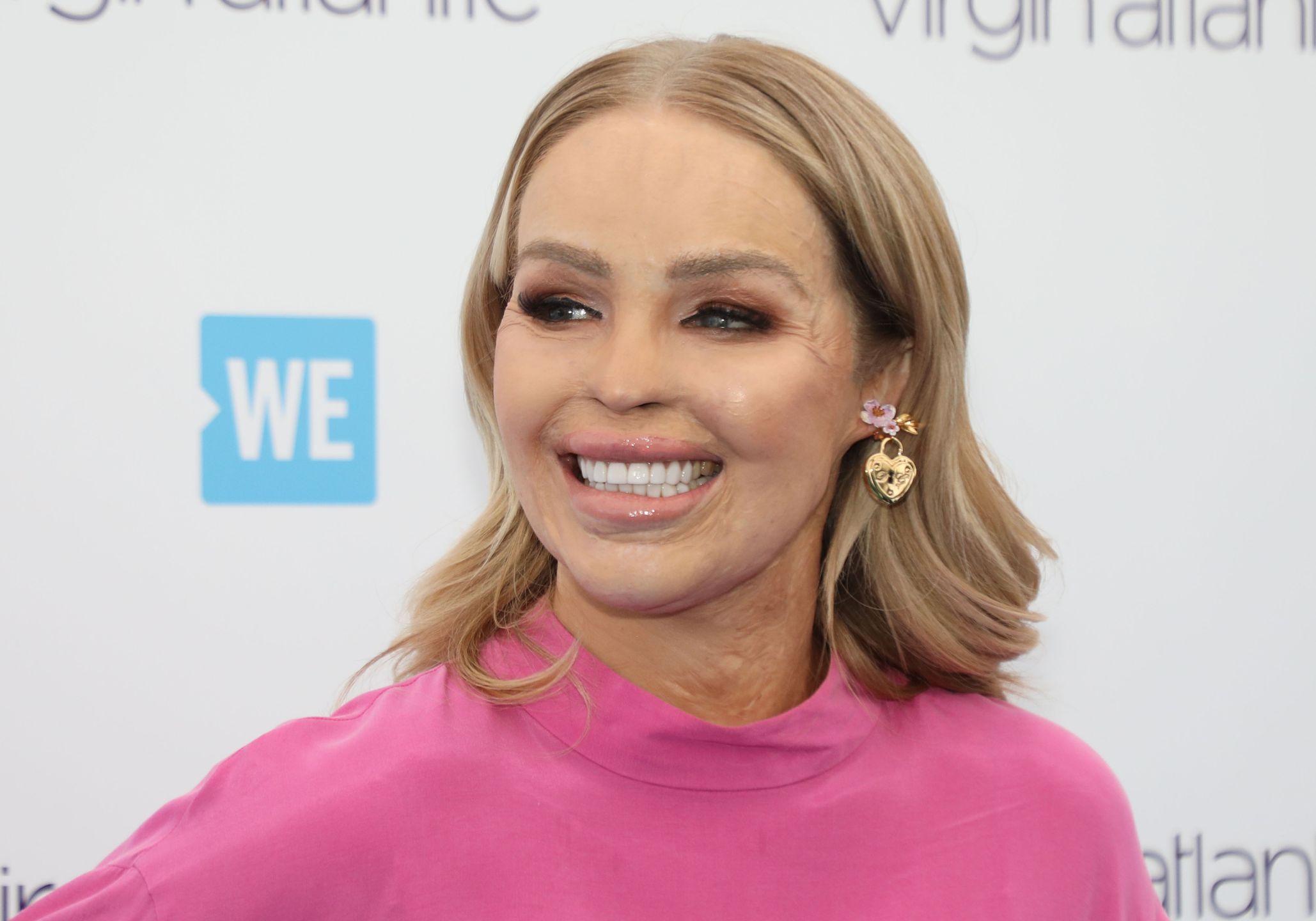 Katie Piper trafiła do szpitala. Ma ważny apel