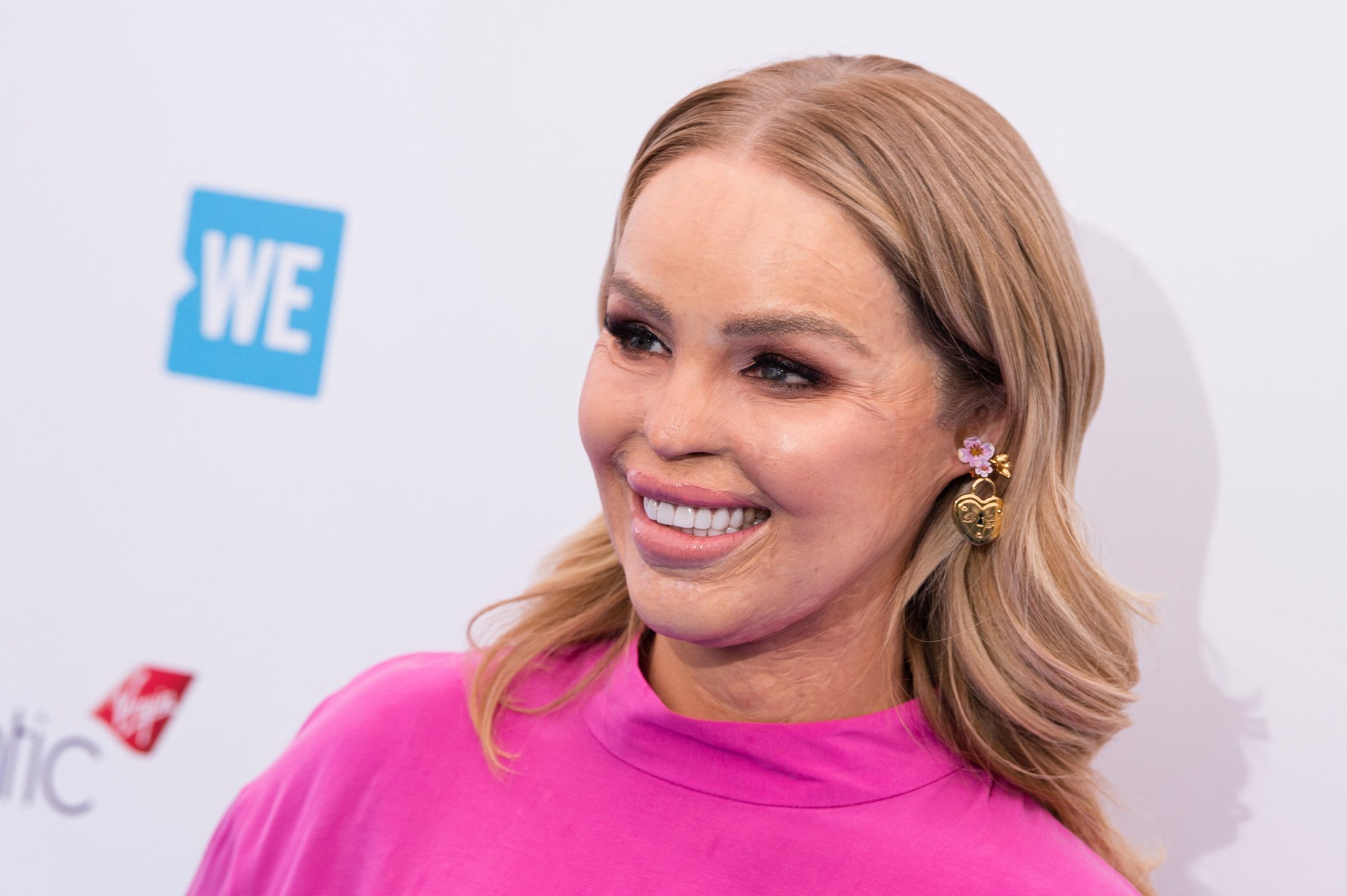 Katie Piper nie czuje się bezpiecznie. Mężczyzna, który oblał ją kwasem, jest na wolności