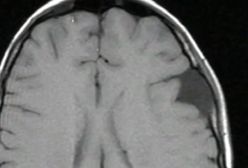 Niezwykły gest właściciela restauracji (WIDEO)