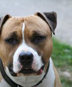 Amstaff pogryzł dwoje dzieci pod Mławą. Prokuratura prowadzi śledztwo, zaskakujące słowa poprzedniej właścicielki