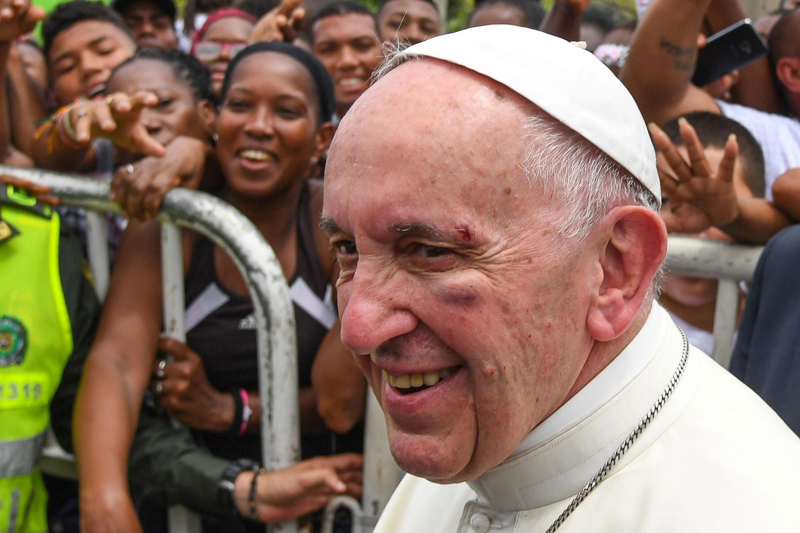 Papież Franciszek miał wypadek w papamobile. Rozbita twarz, krew na ubraniu