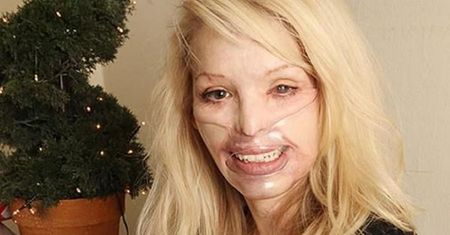 Oblana kwasem Katie Piper na salonach. Prawie nie widać blizn