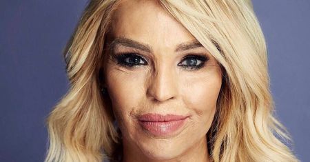 "Czułam, jak moja twarz pali się żywcem". Jak teraz wygląda oblana kwasem Katie Piper?