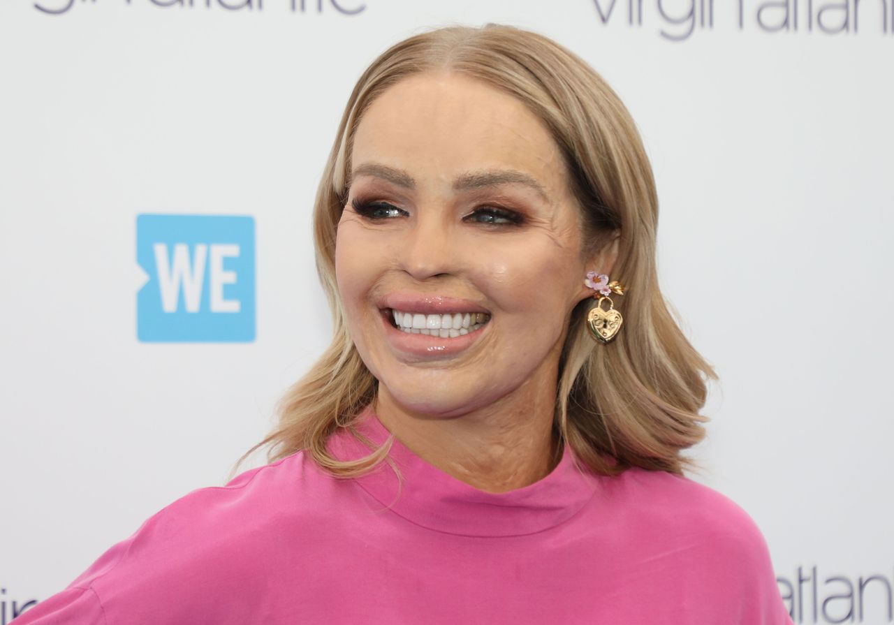 Poparzona Katie Piper ignorowała objawy choroby. Trafiła do szpitala