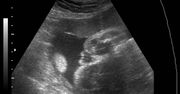 Zdjęcia płodu