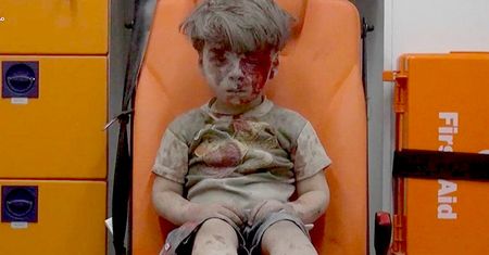 Przeszedł przez piekło w Aleppo. Dzisiaj wygląda zupełnie inaczej
