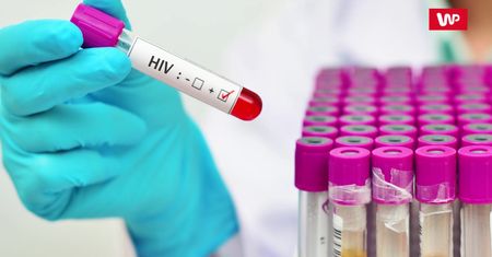 Objawy zakażenia wirusem HIV. Nie są charakterystyczne