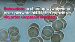 Objawy babeszjozy